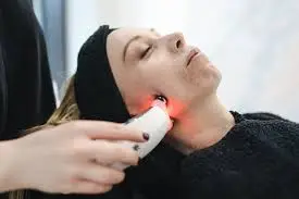 Microneedling